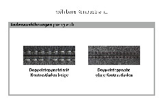 Nahtausführung