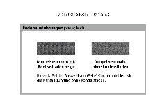 Nahtausführung